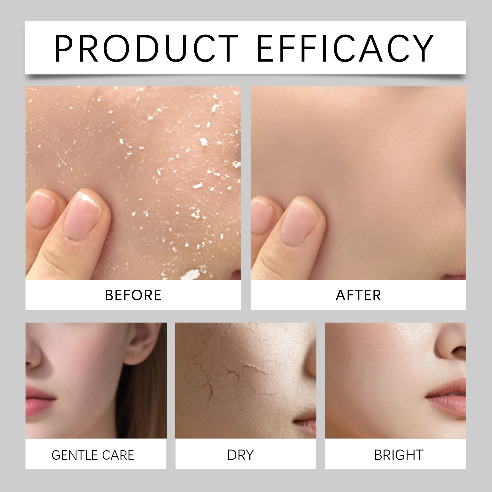 80ml Hydrating Mist for Anti D - Luxury Natural Skincare のレビューと価格